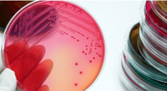 Cloro que mata la escherichia coli